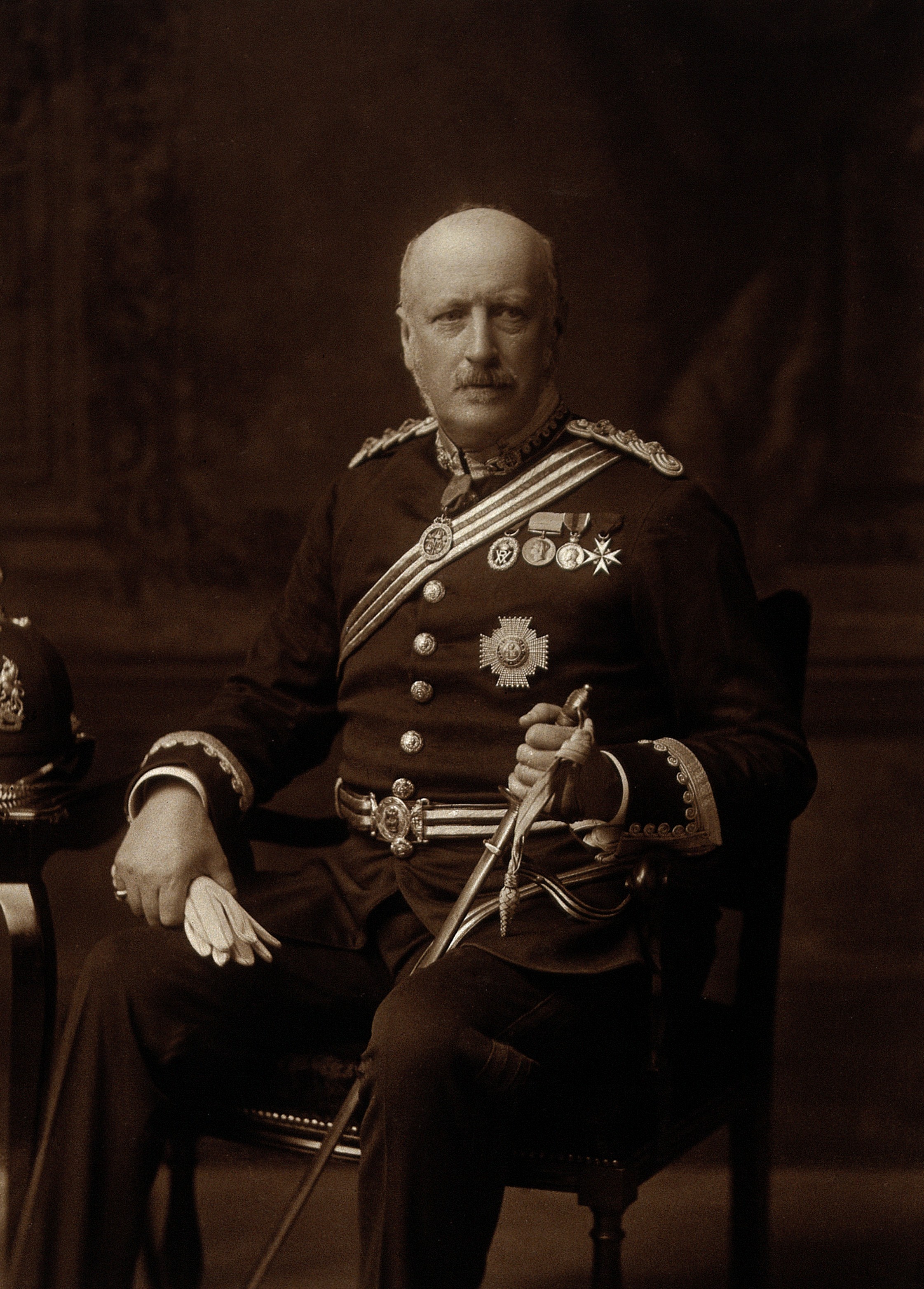 V0026014 Sir George Thomas Beatson. Photograph by Warneuke.